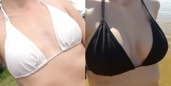 Cream for breast augmentation Wow-Bust before and after use