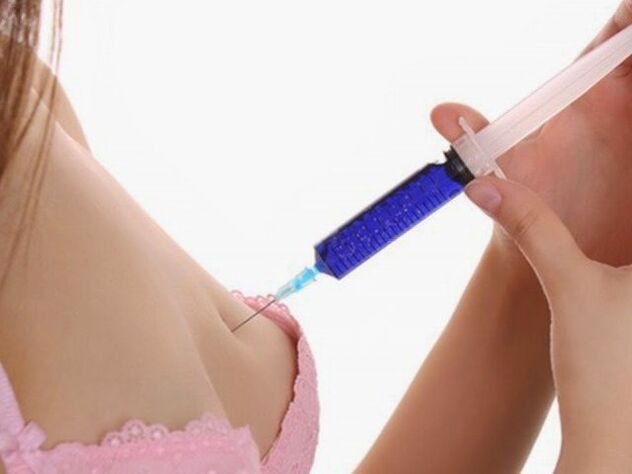 Hyaluronic acid injections for breast enlargement