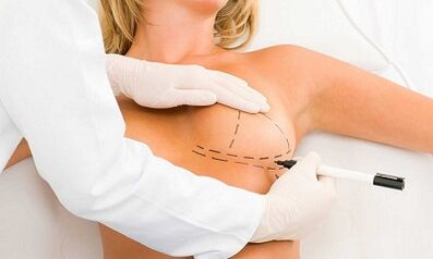 How to increase the lifter of the implants