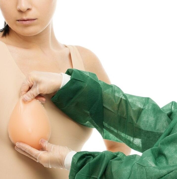 Breast enlargement implants