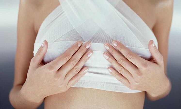 bandaged breasts after breast enlargement surgery